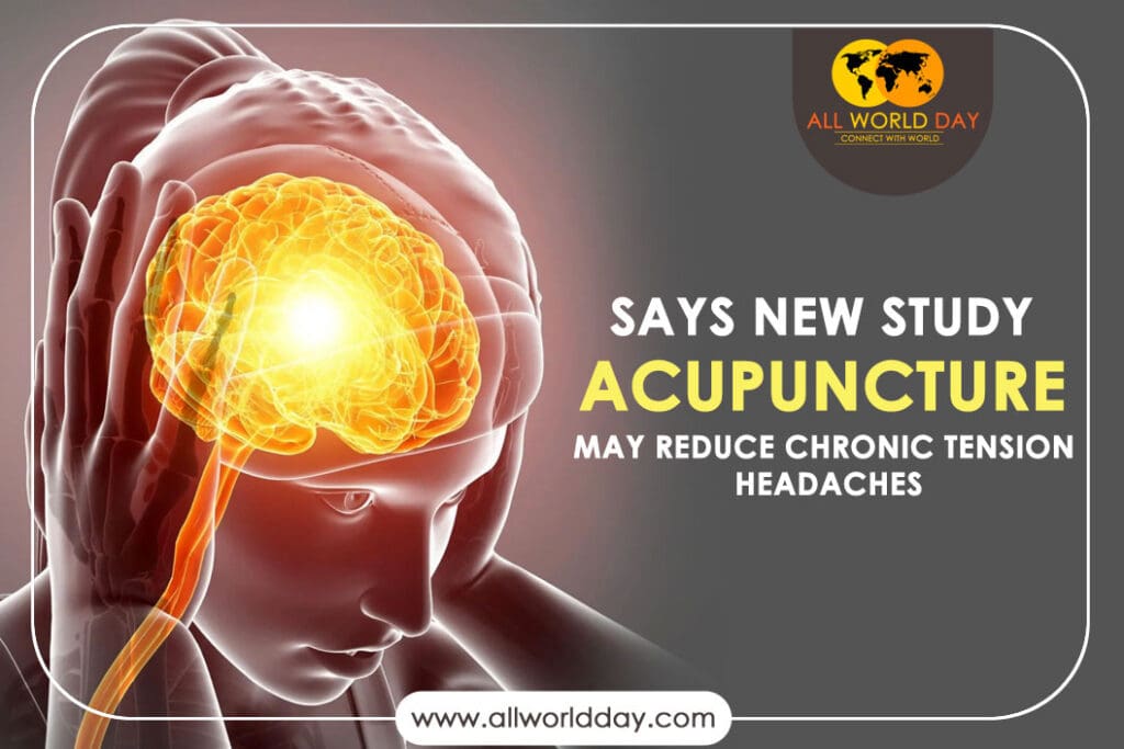 Says New Study: Acupuncture May Reduce Chronic Tension Headaches Says New Study: Acupuncture May Reduce Chronic Tension Headaches