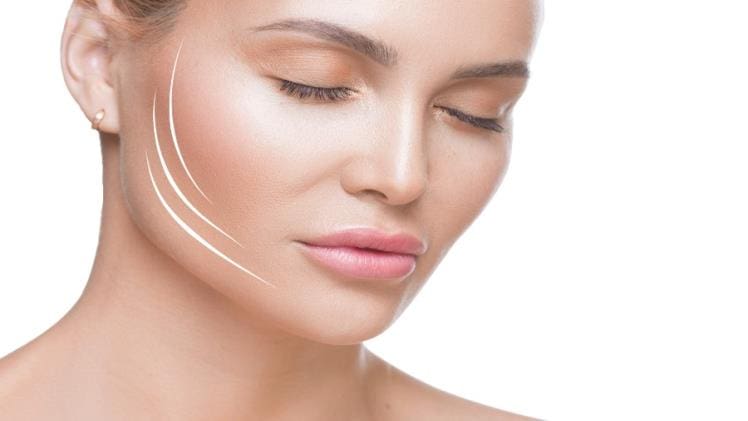 How Long Does Endolift Last?