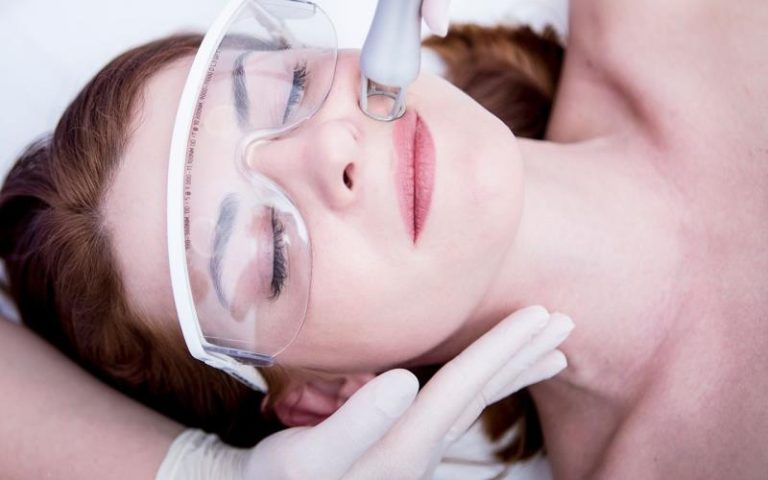 Carbon Laser Treatment: A Laser-Powered Skin Boost